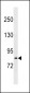 LRCH1 Antibody (Center)